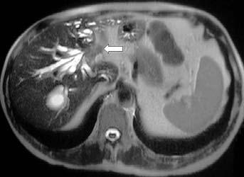 258 MRI of the Liver c d e f g h Fig. 30-h.