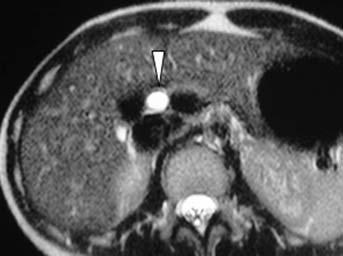 242 MRI of the Liver c d e f g