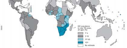 Estimated HIV Prevalence in New TB Cases, 29 (per 1,) Global