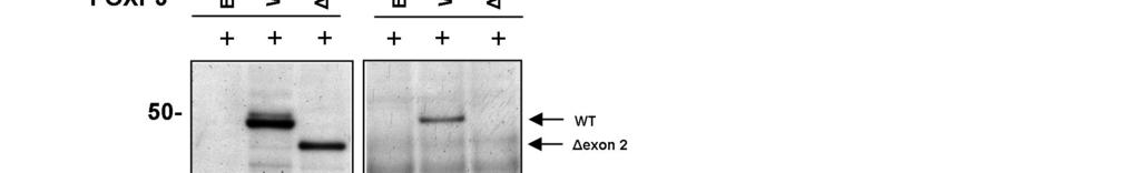 -WT ΔEx2 WT ΔEx2 Association of Foxp3 with Depends in
