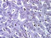 Polyclonal CEA and CD 10 highlight bile canaliculi in normal liver.
