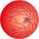 Like other parts of the body, the retina needs blood to function correctly. Blood flows to the retina through small blood vessels.