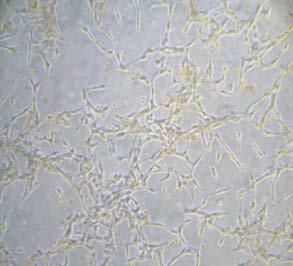 HNSCC tissues OCT4 Nanog Spheroid