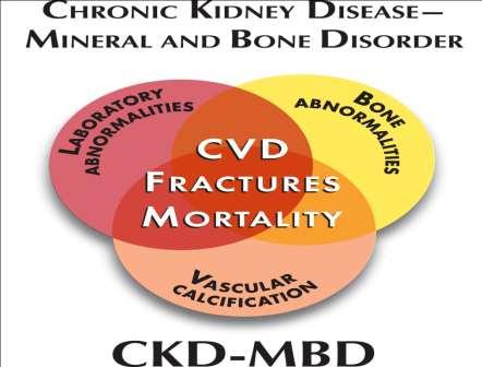 Mineral & Bone Disorder (MBD) Systemic Complication in CKD Mineral Hormonal Bone