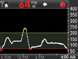 Low glucose alert set at 80 mg/dl Low glucose alert setting 9.1.2.