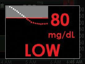 Do not rely solely on CGM alerts to detect low glucose. The Dexcom G4 PLATINUM (Pediatric) System also has a fixed low alarm at 55 mg/dl.