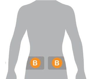 Insertion in those areas might affect sensor accuracy and could result in you missing severe hypoglycemia (low blood glucose) or hyperglycemia (high blood glucose) events.