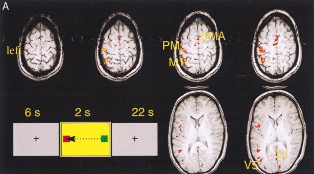 Neurobiology: Menon et al. Proc. Natl. Acad. Sci. USA 95 (1998) 10905 pixels in contralateral primary M1 of all six subjects even though the motion duration was 300 ms (Fig. 2A).