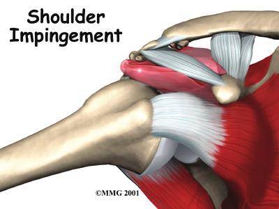 Introduction The shoulder is a very complex piece of machinery. Its elegant design gives the shoulder joint great range of motion, but not much stability.