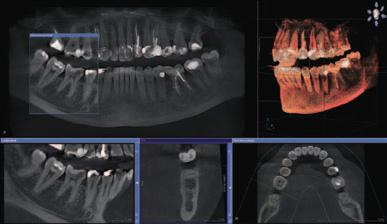 your network. GALAXIS then guides the user effectively through the 3D volume to expedite diagnosis even in difficult cases. GALILEOS Implant allows you to achieve improved safety during implantation.