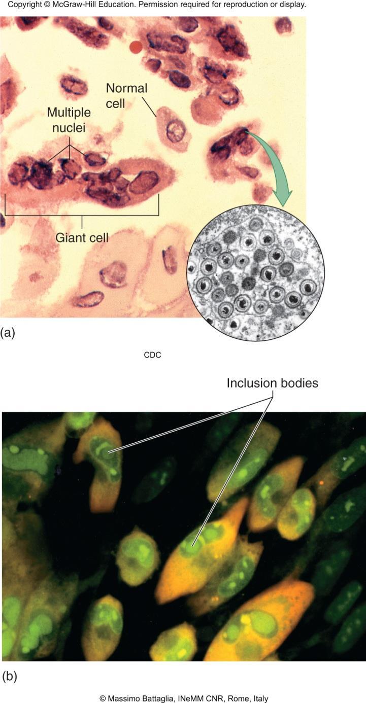 Damage to host cell Cytopathic effects - virus-induced damage to cells 1. Changes in size and shape 2.