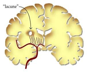 Cerebellum, Brain Stem, Occipital Lobe and some Mid Brain and Cervical Spine Small