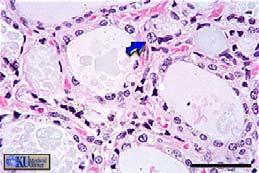 cells (follicle cells) Follicular cells take up Iodine from circulation and