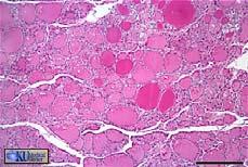 stored in the colloid of follicle Thyroid gland Thyroid Gland An elusive
