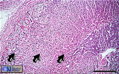 Adrenal Gland Adrenal Cortex medulla Endocrine tissue that produces a variety of corticosteroids (general term for