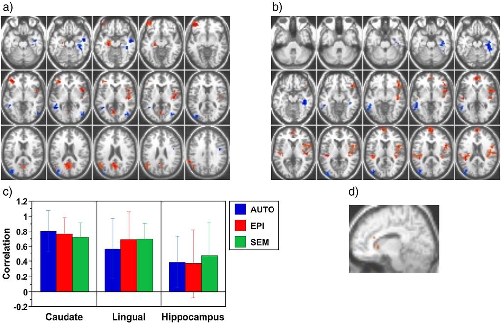 870 H. Burianova et al. / NeuroImage 49 (2010) 865 874 Fig. 1. Seed PLS results: common functional network. (a) A pattern of correlated activity at 6 8 s after retrieval onset is shown.