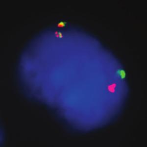 In nuclei with no rearrangement, orange-red and green signals will