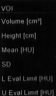 Bed height, Magnification