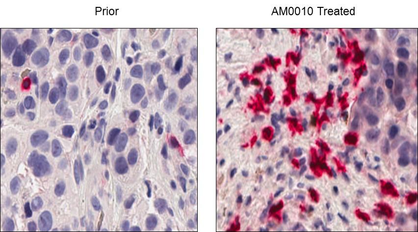 AM0010 Increases Intra-Tumoral CD8 + T Cell Numbers AM0010 Monotherapy Increases the Number of