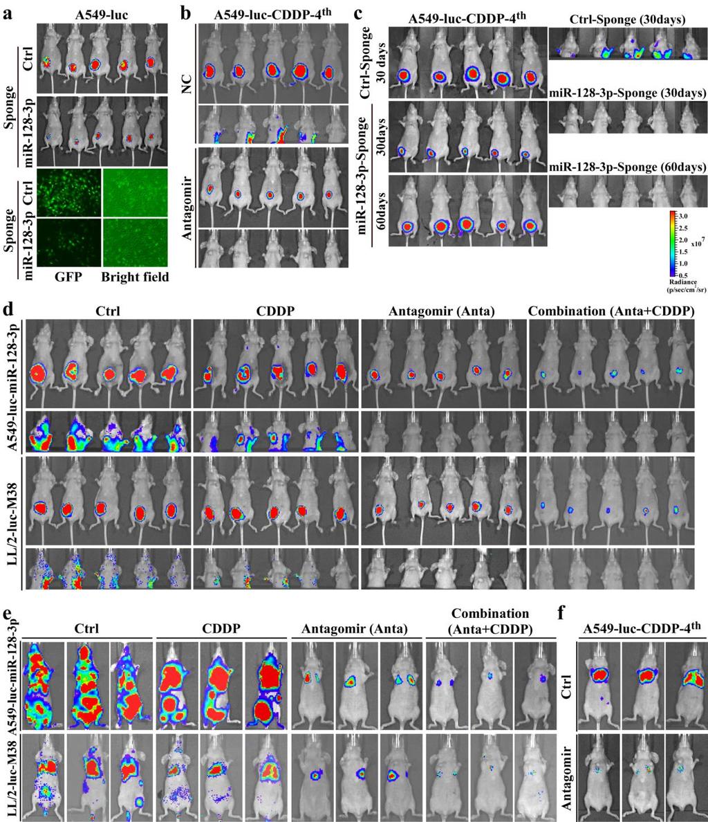 Supplementary Figure 7 Therapeutic effect of inhibiting mir-128-3p on tumor growth and distant metastasis and chemoresistance.