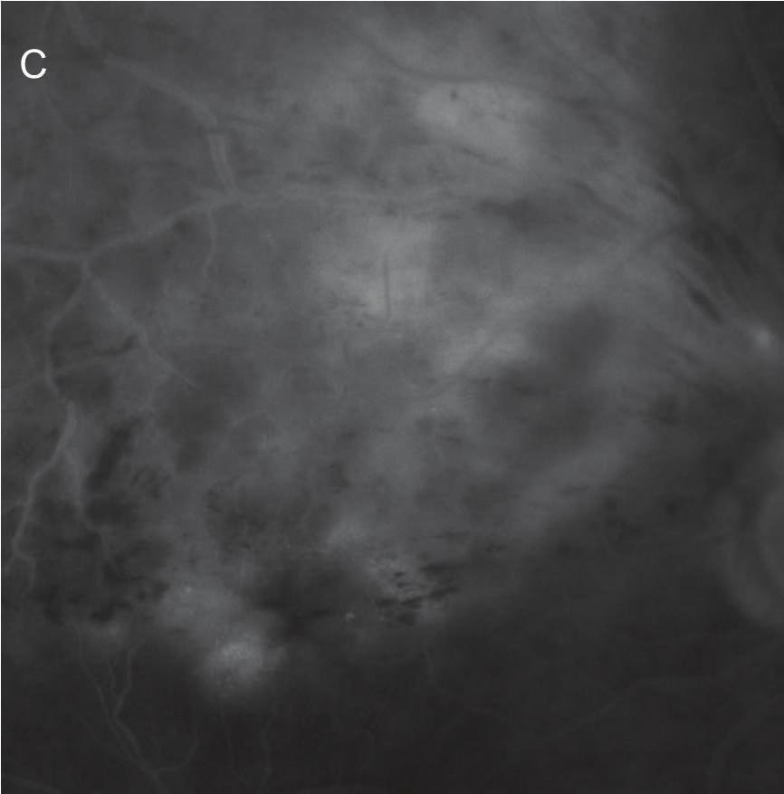 methods used in this study, including observation using OCT and FAF for eyes with macular and