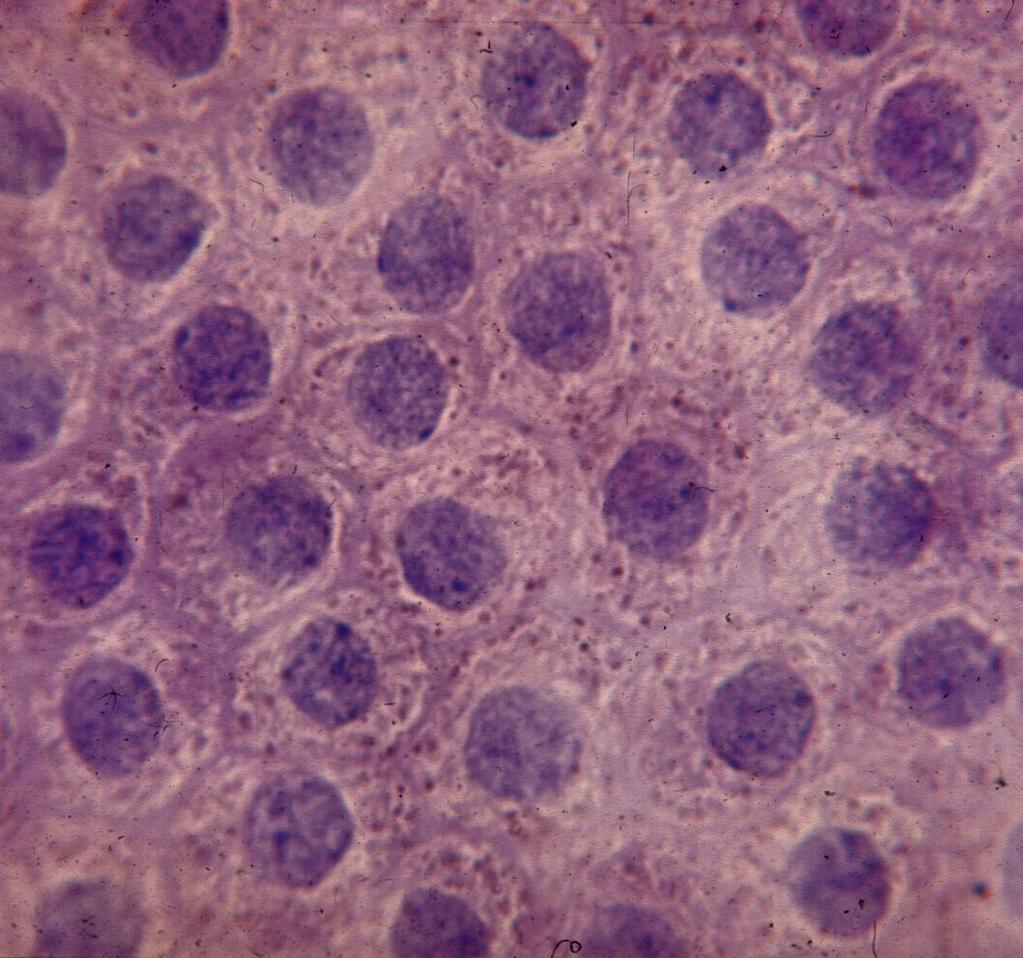Retinal Pigmented Epithelium RPE cells are joined by tight junctions.
