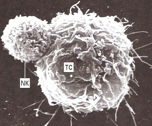 NATURAL KILLER CELL FUNCTIONS AND SURFACE RECEPTORS INTRODUCTION Natural killer cells are classified as lymphoid cells, it thought to be derived from lymphoid cell progenitors in the bone marrow, and