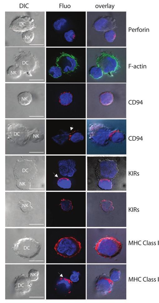 Figure 4 CD94, KIRs, and MHC class I polarized to the cell-to-cell contact area, but perforin and F-actin did not segregate during DC/NK cell interactions.