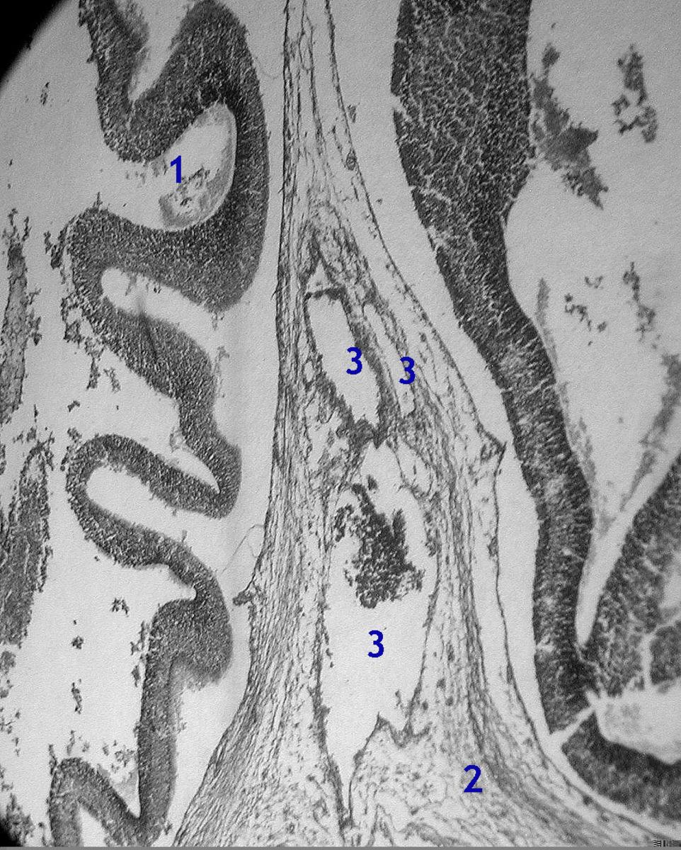 Fig. 5: 50 mm CR length embryo showing the venous plexus, precursor of the vein of Galen within the primitive dural mesh