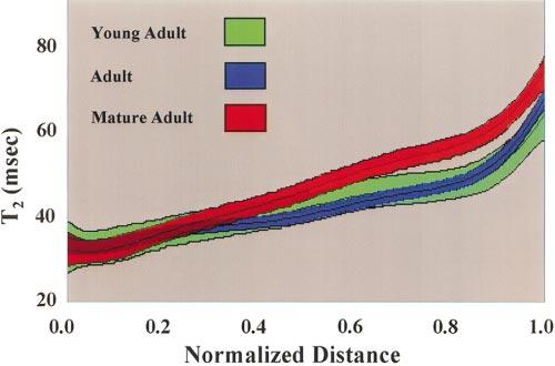 Figure 1. Spatial variation in cartilage T2 as a function of age for the following groups: young adult (18 30 years), adult (31 45 years), and mature adult (46 60 years).