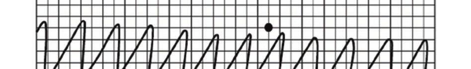 The three dots above the upper trace are the calibration dots: the first dot, the lowest of the three, is the baseline level recorded before any oxygen is added, the second dot is after adding 1 dm 3