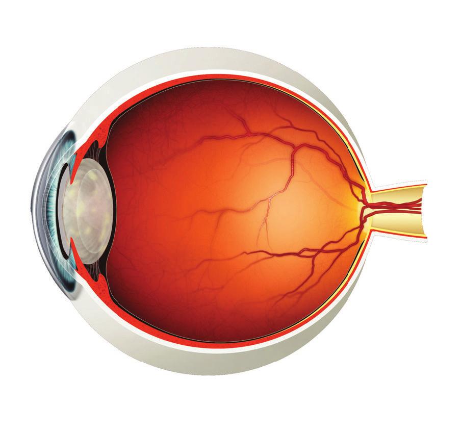 What is a Cataract? Behind the iris* of our eye sits a coloured part known as the lens. This is a transparent disc that makes use of light to help us see.