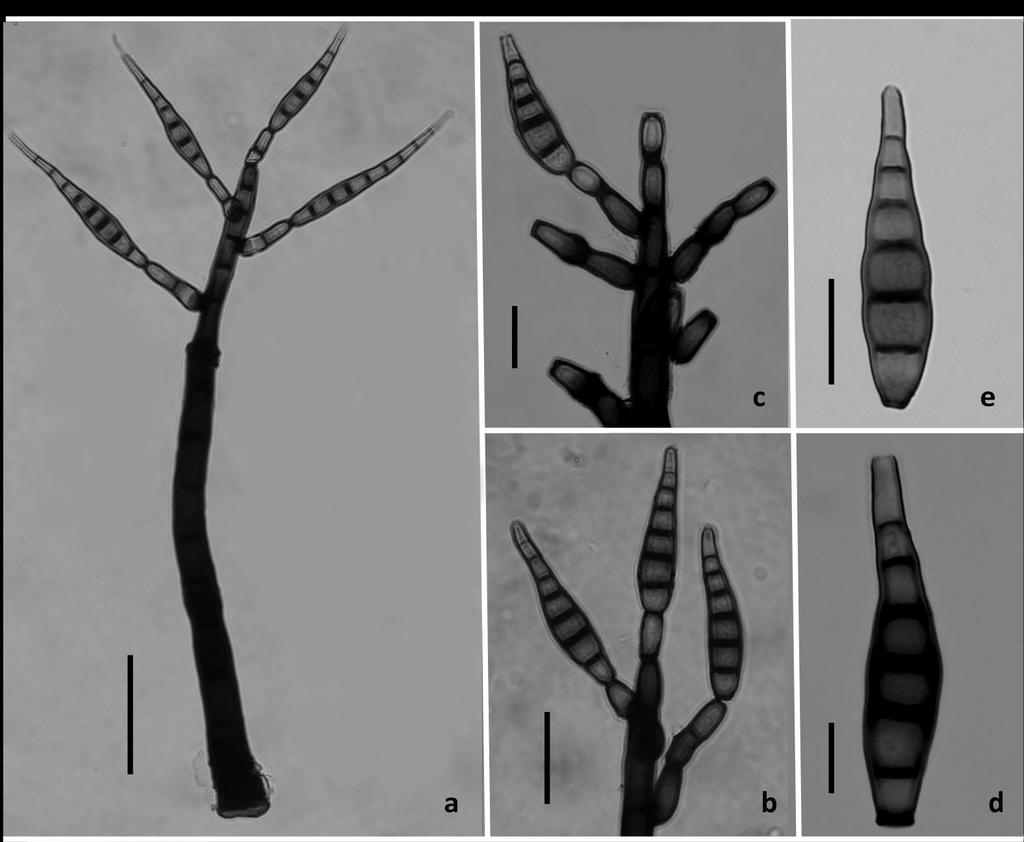 Fig. 1 a e Ellisembiopsis brasiliensis. a General aspect. b c Details of branches of conidiophores and conidiogenous cells. d e Conidia. Bars =10 µm (d); 20µm (b, c, e) 50 µm (a). MycoBank 803135 Bas.