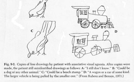 Interestingly, some patients are still able to draw objects from memory, despite being unable to copy them. Apperceptive Agnosia Associative Agnosia "Perception without meaning".