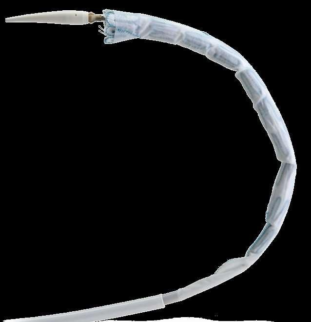 RelayBranch: Design Overview Based on RELAY NBS PLUS: DUAL SHEATH SYSTEM PRE-CURVED NITINOL INNER CATHETER Tracking through the arch, the pre-curve enhance the alignment of the stentgraft