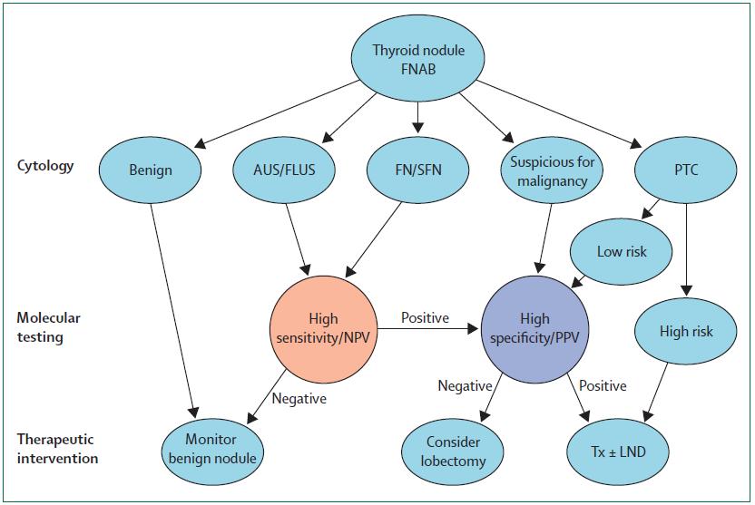 Molecular tests on FNAC for management of thyroid nodules Xing M, Lancet 2013,381:1058-1069 Figure 3: Algorithm for management of thyroid nodules on the basis of FNAB and molecular marker tests