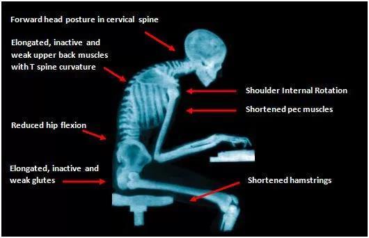 Thoracic Spine OR T-Spine http://omega-rehab.