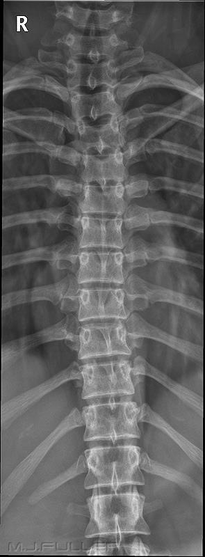 AP View What do you notice about this thoracic spine x-ray? What organs do you see? What organs or bones do you think you should see but do not?