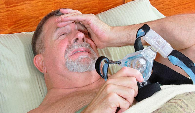 Side Effects of PAP Therapy Frequent nocturnal awakenings Nasal irritation