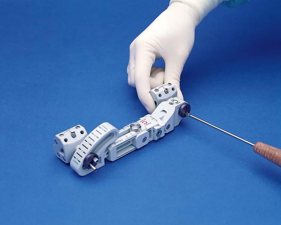 Configure Fixator The adjustable distal radius fixator is packaged for application to the right wrist.