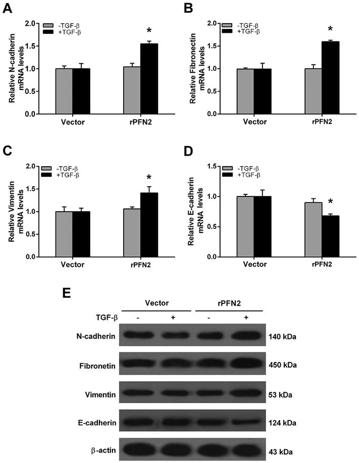 Yan et al: mir-30a 5p inhibits emt in high invasive NSCLC cell lines 3149 Figure 3. PFN2 promotes TGF-β-induced EMT in high invasive non-small cell lung cancer cell line.
