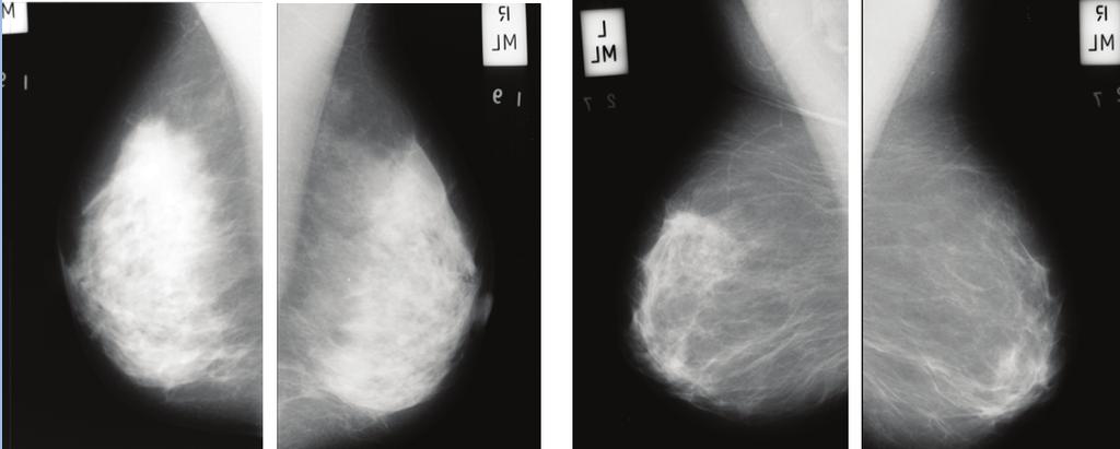 Metrological Assessment of a CAD System for the Early Diagnosis of Breast Cancer in Digital Mammography Metrological Assessment of a CAD System for the Early Diagnosis of Breast Cancer in Digital