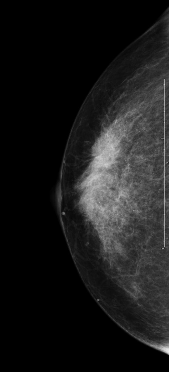 406 Mammography Recent Advances Fig. 2.1.