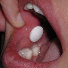 is dissolved in saliva and either swallowed or absorbed buccally Rachid et al., 211.
