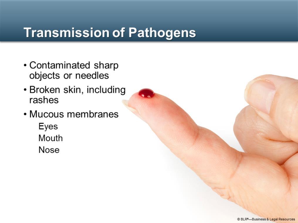 Transmission of pathogens in the work environment is most likely to occur in the following ways: First, transmission by contaminated sharp objects or needles is the most common way if you are cut