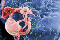 HIV HIV is the human immunodeficiency virus.