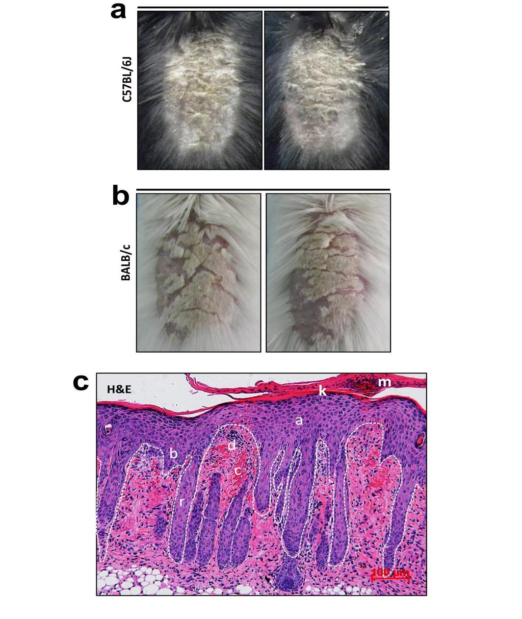 Supplementary Figure 1 IMQ-Induced Mouse Model of Psoriasis. IMQ cream was painted on the shaved back skin of CBL/J and BALB/c mice for consecutive days.
