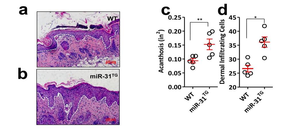 9 10 11 Supplementary Figure Increased Disease Severity in mir-1 TG Mice Treated with IMQ. (a, b) H&E staining of the back skin of WT or mir-1 TG mice treated with IMQ.