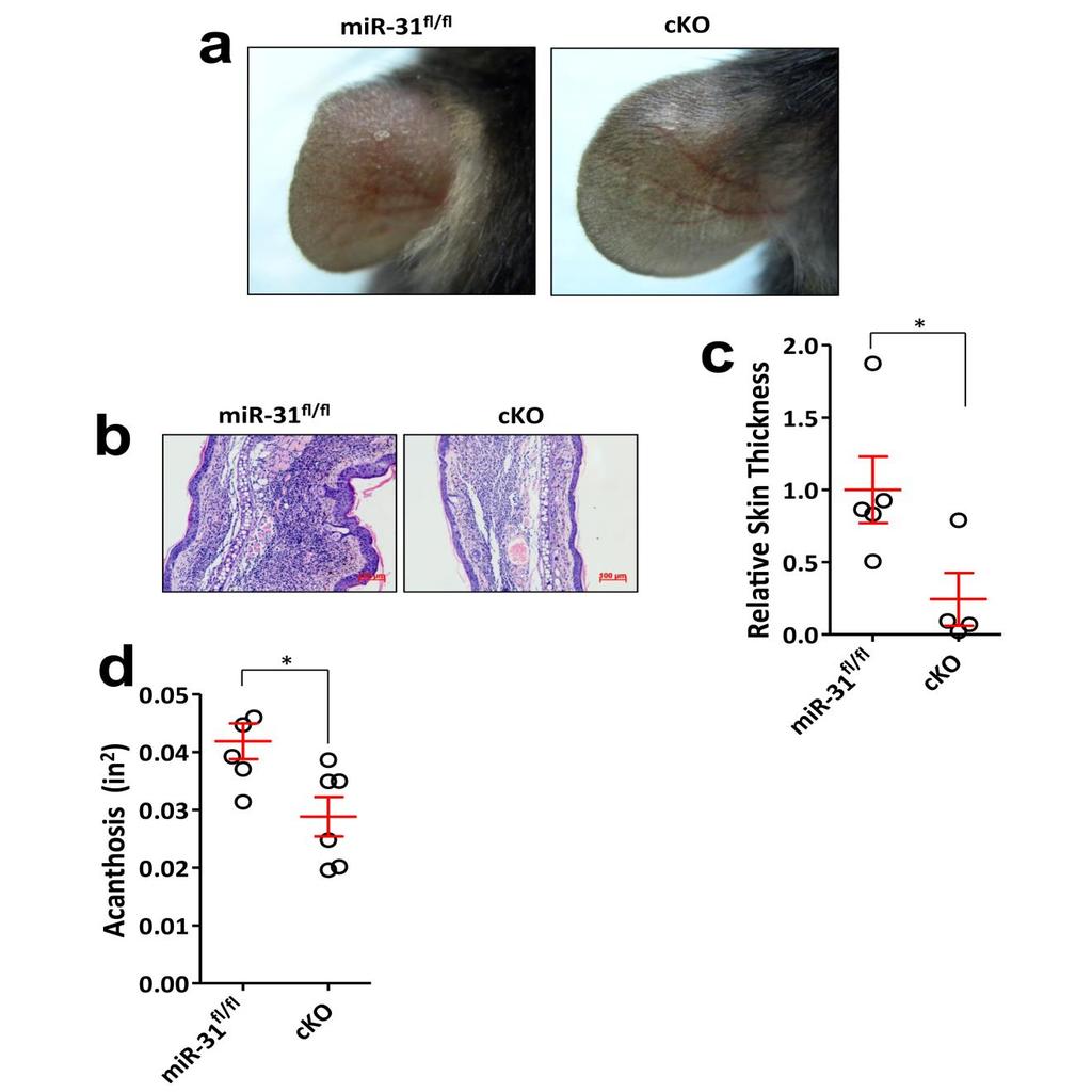 Supplementary Figure Decreased Disease Severity in cko mice after IL- Treatment.