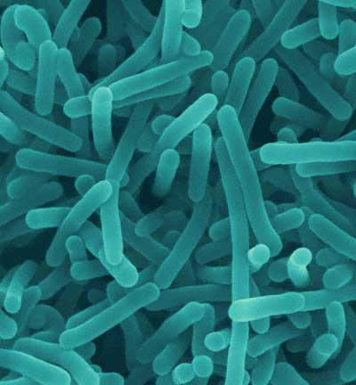 16 2.6.2 Morfološke značilnosti Bakterije rodu Listeria so majhne (široke 0,5 μm in dolge 1 do 2 μm), po Gramu pozitivne, gibljive paličaste bakterije z zaokroženim koncem, sicer nesporogene, a